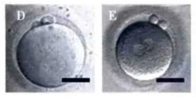 助孕男孩-40天彩超能查出怀孕吗